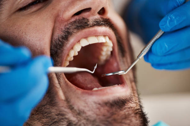 Best Weekend Emergency Dental Services in Boulder Hl, IL