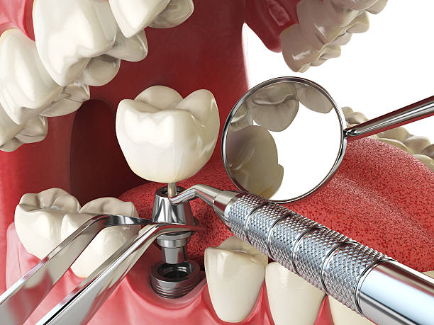 Best Emergency Treatment for Jaw Pain or Injury in Boulder Hl, IL